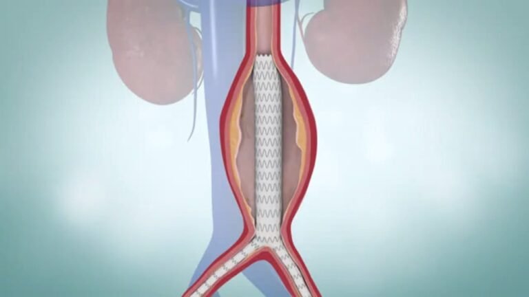 Aortic artery