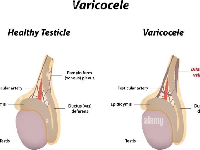 Can arterial atherosclerosis cause male sexual dysfunction?